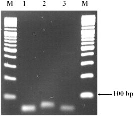 Objectives A multiplex real-time polymerase chain reaction (RT-PCR) method was developed for the identification of three Vibrio species: Vibrio cholerae , Vibrio parahaemolyticus , and Vibrio vulnificus . Methods Specific primers and probes targeting
