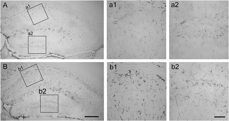 Objectives Nonionizing radiation is emitted from electronic devices, such as smartphones. In this study, we intended to elucidate the effect of electromagnetic radiation from smartphones on spatial working memory and progenitor cell proliferation in 
