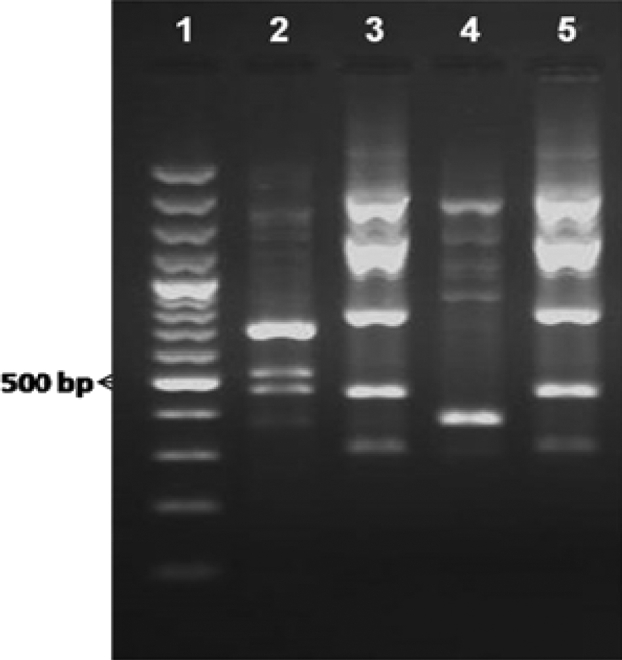 Objectives Escherichia coli is regarded as the most important etiological agent of urinary tract infections. Fluoroquinolones are routinely used in the treatment of these infections; however, in recent years, a growing rate of resistance to these dru