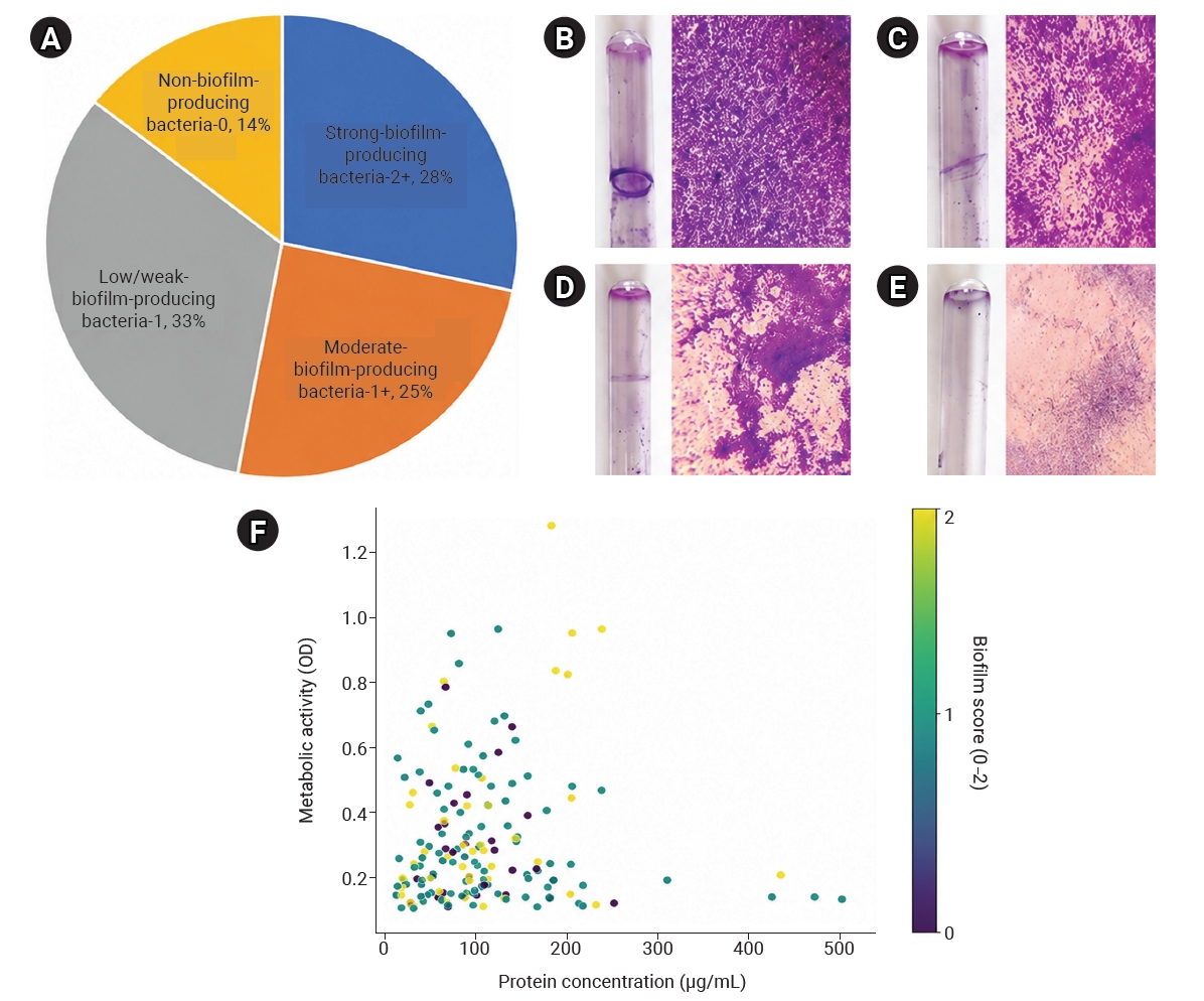 Objectives: This study characterized multidrug-resistant (MDR) bacteria in sewage, river, and marine ecosystems in South Gujarat, India. Methods: Water samples were collected from 25 hospital drainage, sewage treatment/pumping, Tapi River, and coasta