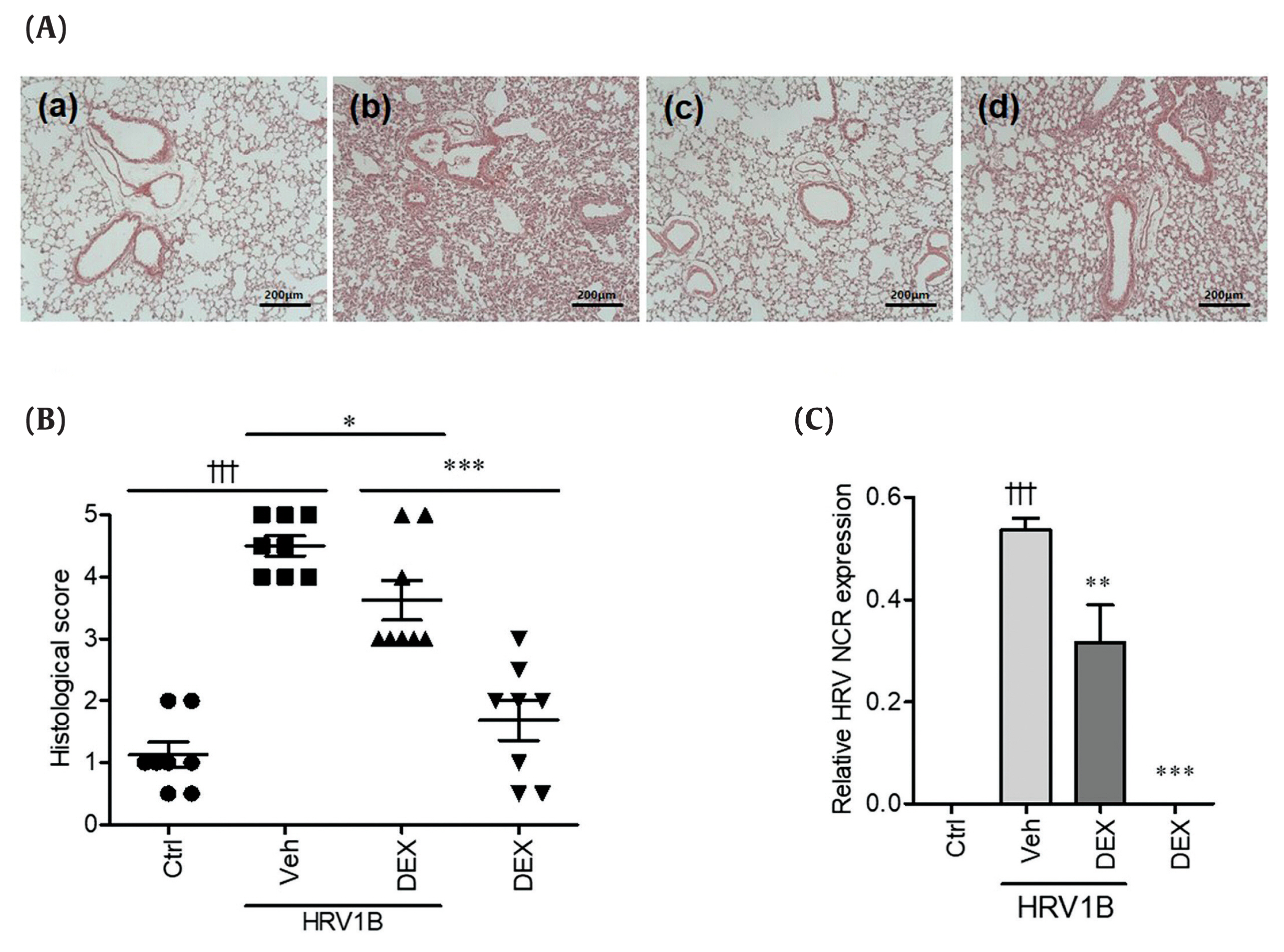 Objectives Human rhinoviruses (HRVs) are the major cause of the common cold. Currently there is no registered, clinically effective, antiviral chemotherapeutic agent to treat diseases caused by HRVs. In this study, the antiviral activity of dexametha