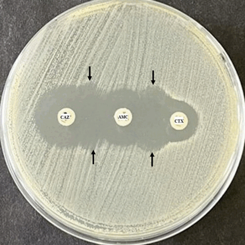Positive finding extended-spectrum beta-lactamase production in Klebsiella pneumoniae screening by the disk diffusion test. Left to right: CAZ–AMC–CTX.CAZ, ceftazidime; AMC, amoxicillin-clavulanate; CTX, cefotaxime. Black arrow: increase diameter in 