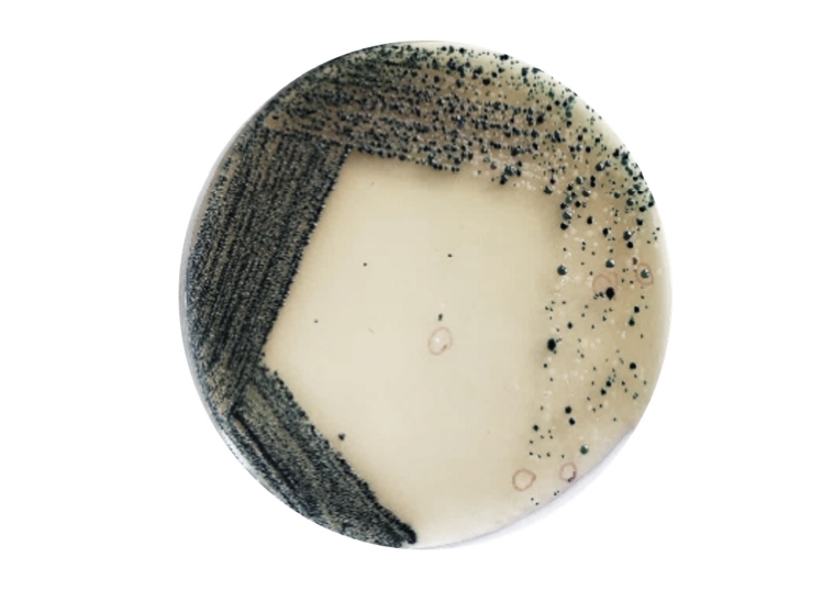 Primary isolation of bacterial isolates on HiCrome Universal Differential Medium (HiMedia Laboratories Pvt. Ltd.), showing representative mixed colony morphologies and chromogenic differentiation used for presumptive grouping before further phenotypi