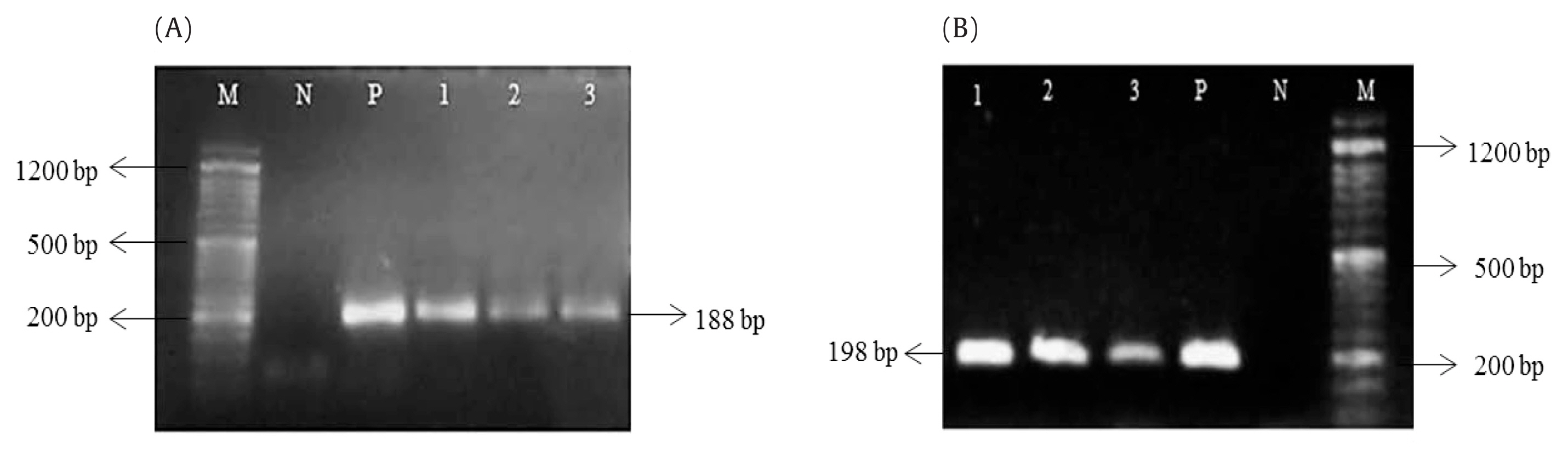 Agarose gel electrophoresis of icaA (A) and icaD (B) genes in S epidermidis isolates. Lanes 1–3 = PCR products of the corresponding genes; M= 50 bp DNA marker; N = negative control; P = positive control.